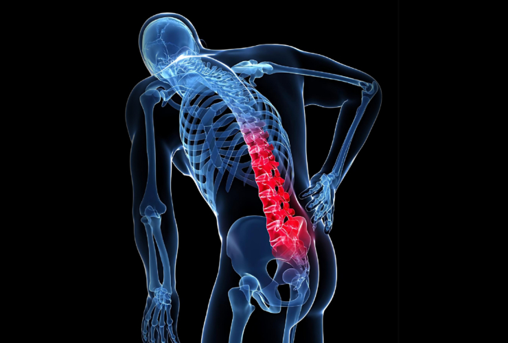 Πρωινή δυσκαμψία μέσης