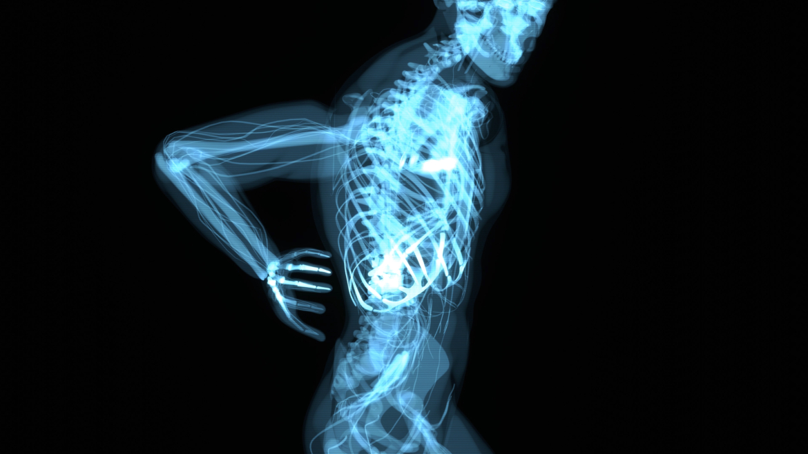 Εκφυλιστική δισκοπάθεια: Από τις πρώιμες αλλαγές έως τη σύγχρονη αντιμετώπιση