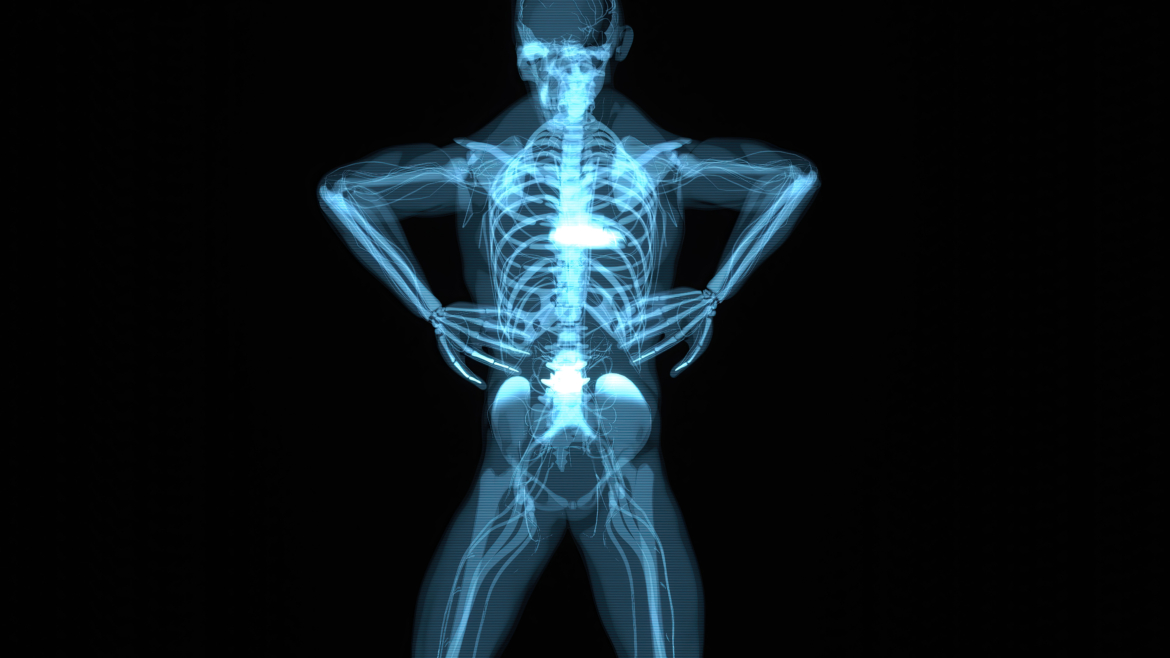 Πόνοι μετά από σπονδυλοδεσία: Είναι φυσιολογικοί;