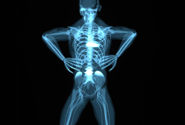 Πόνοι μετά από σπονδυλοδεσία